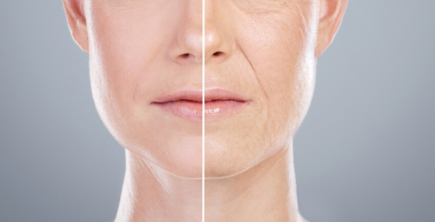 Anti Aging
